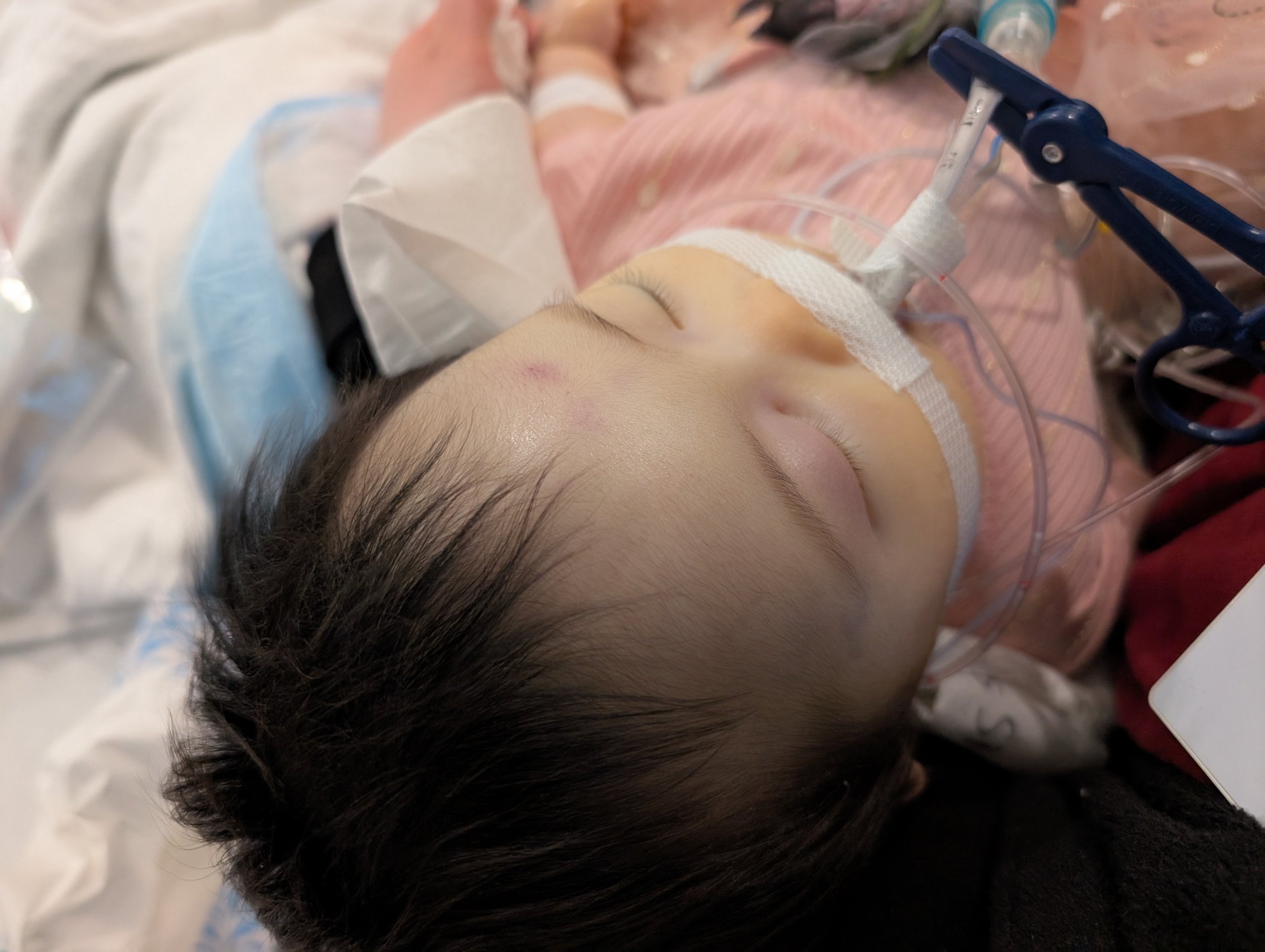 Final moments of Baby Ce